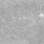 Бациллюс субтилис (Bacillus subtilis, сенная палочка): биохимические свойства, выращивание и применение